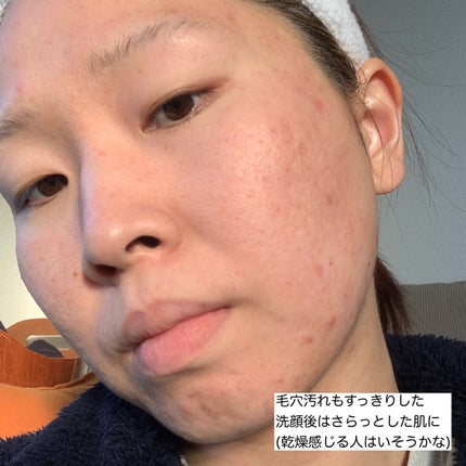 æ¯ç©Žå°çº ãã«ãªæºæ²» ãã¡ãã¡ãã©ãã¯æŽé¡/ã¯ãªã¢ã¿ãŒã³/æŽé¡ãã©ãŒã ã䜿ã£ãã¯ãã³ãïŒ8æç®ïŒ