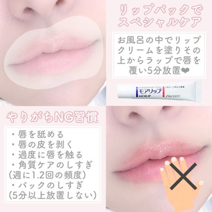 モアリップ N (医薬品)/資生堂薬品/その他を使ったクチコミ(5枚目)