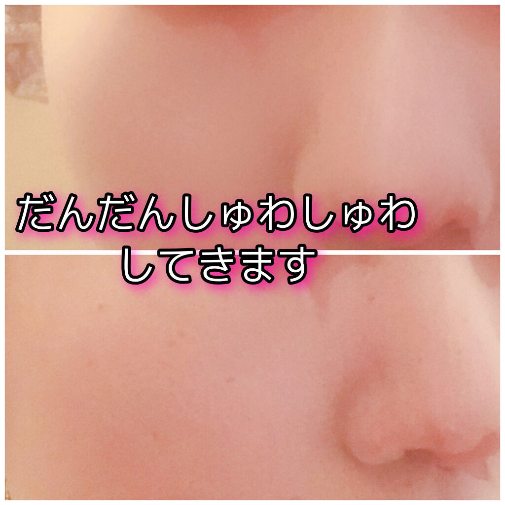 海藻（シーウィード）バブル クレイマスク/phykology/洗い流すパック・マスクを使ったクチコミ（3枚目）