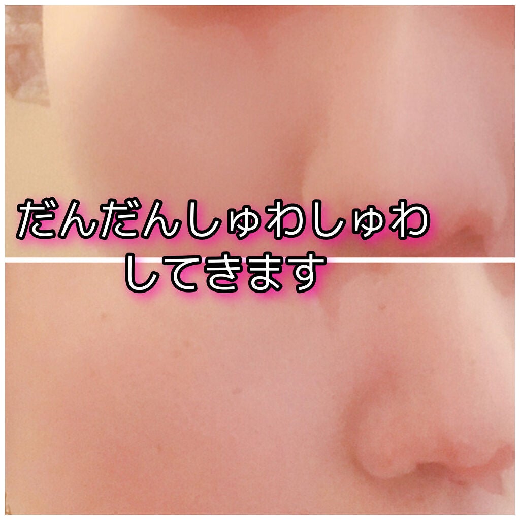 海藻(シーウィード)バブル クレイマスク/phykology/洗い流すパック・マスクを使ったクチコミ(3枚目)