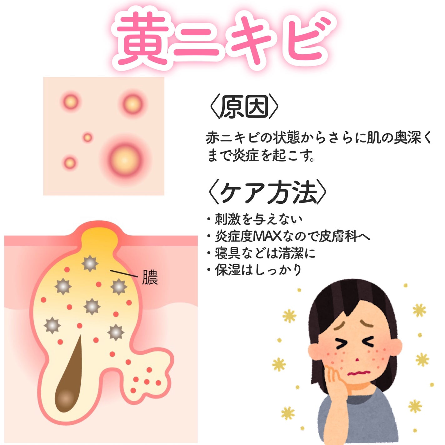 潤浸保湿 フェイスクリーム/キュレル/フェイスクリームを使ったクチコミ(5枚目)