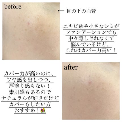 ピンクティーツリーカバーアップグロウクッション/APLIN/クッションファンデーションを使ったクチコミ(3枚目)