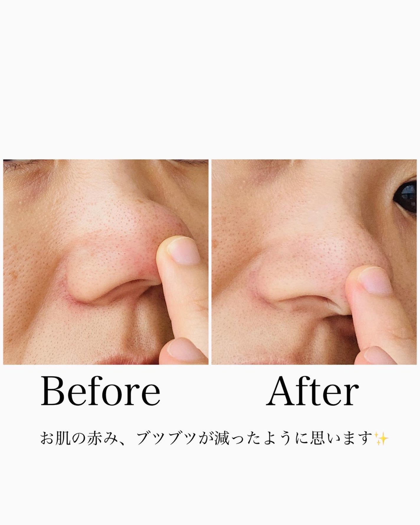 ロゼットゴマージュ/ロゼット/ピーリングを使ったクチコミ(5枚目)