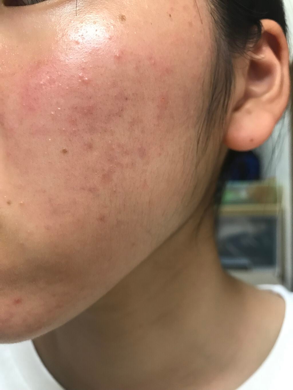 デュオ ザ クレンジングバーム クリア/DUO/クレンジングバームを使ったクチコミ(4枚目)