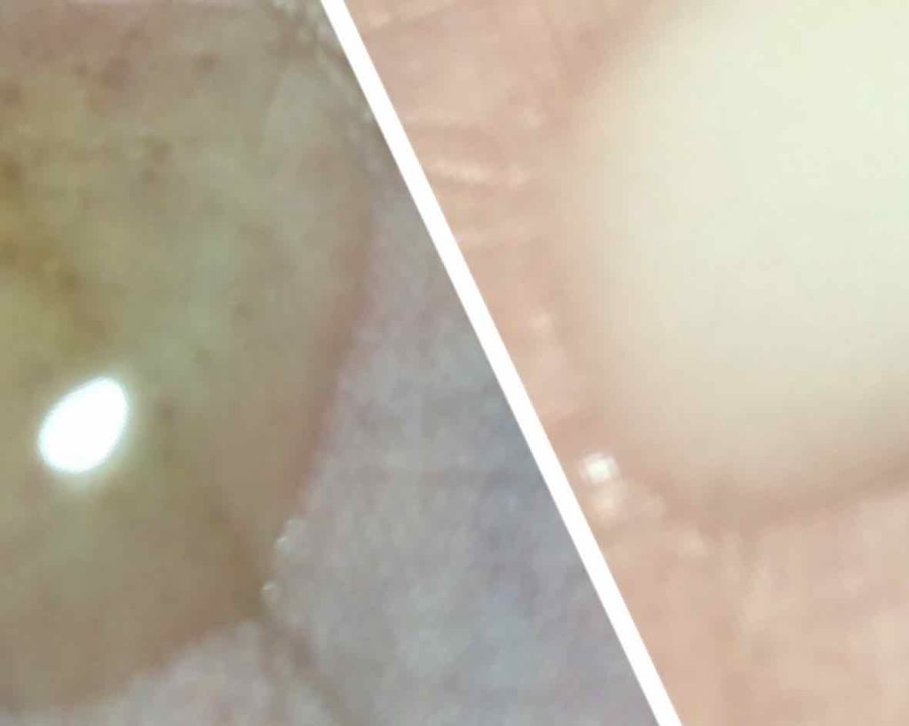 POWER 10 FORMULA LI EFFECTOR/It's skin/美容液を使ったクチコミ(3枚目)