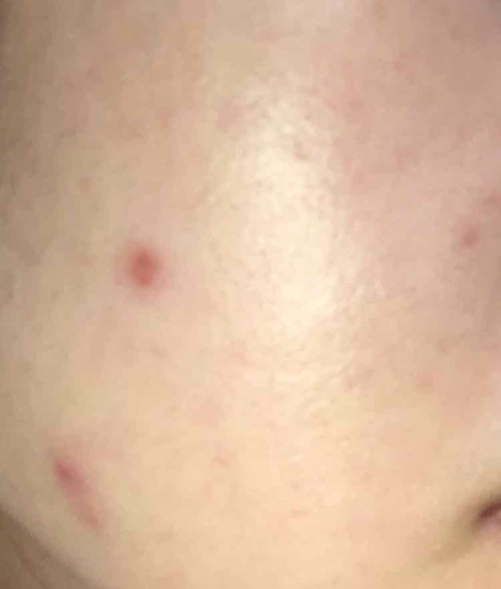twinkle_rouge_r85 on LIPS 「肌日記昨日に引き続き乾燥ざらつき謎ブツブツのフェイスラインにイ..」(2枚目)