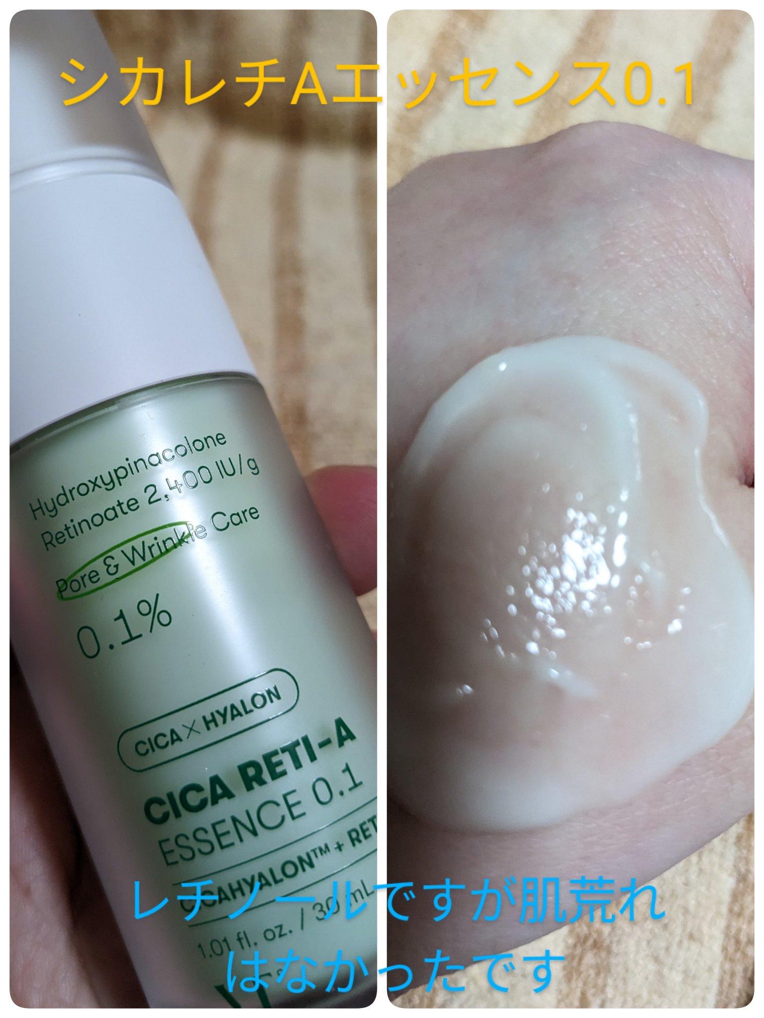 シカレチA エッセンス0.1/VT/美容液を使ったクチコミ（3枚目）