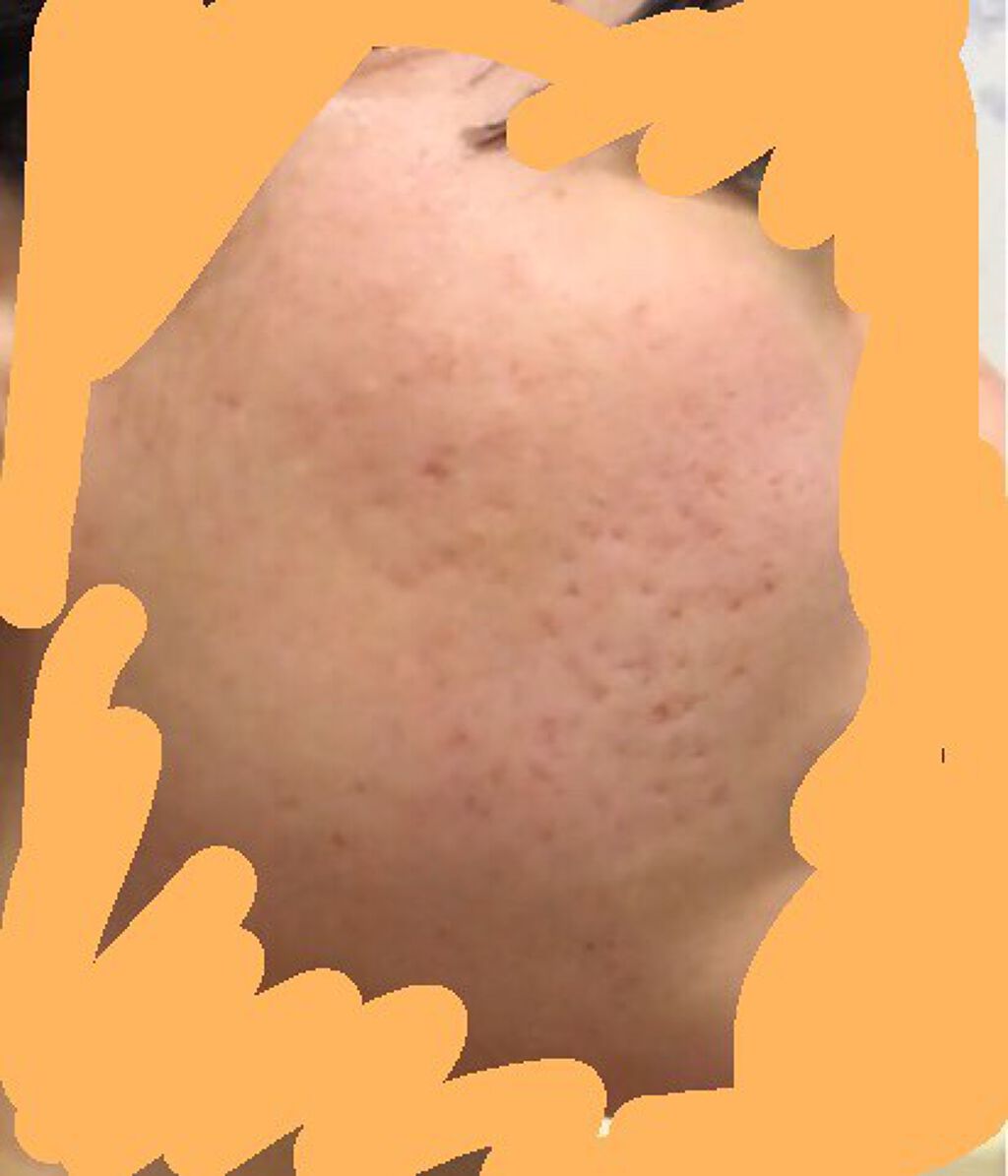 ハトムギ化粧水(ナチュリエ スキンコンディショナー R )/ナチュリエ/化粧水を使ったクチコミ(2枚目)