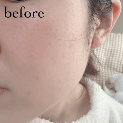 グリーンカーミングセラムミスト/Free Moment /ミスト状化粧水を使ったクチコミ(5枚目)