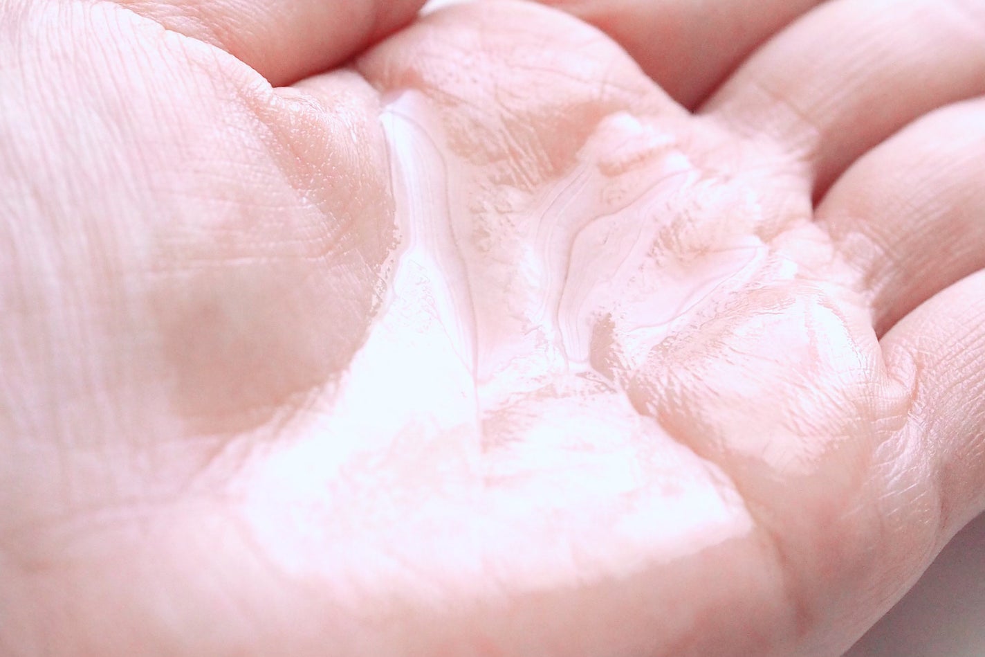 カラミー カラミンノーセバムローション/Calamee/化粧水を使ったクチコミ(5枚目)