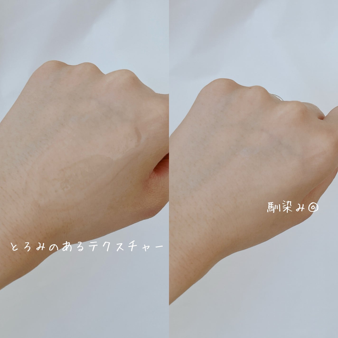 リマージ糸リフティングアンプル/REVENIP/美容液を使ったクチコミ(7枚目)