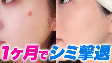 Kiehl's DS RTN リニューイング セラムのクチコミ「一撃でシミを消した方法

詳しくはこちら🔻

https://youtu.be/TVf.....」（1枚目）