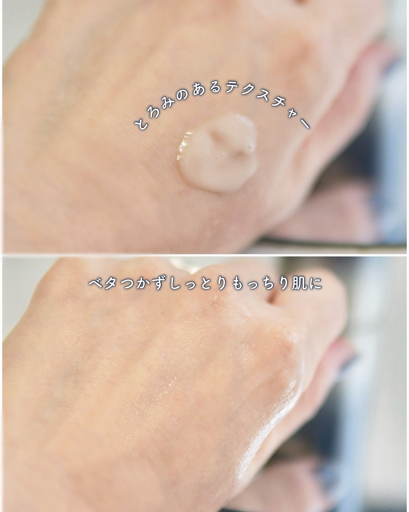 ブラックスネイルレチノールセラム/Dr.G/美容液を使ったクチコミ(3枚目)