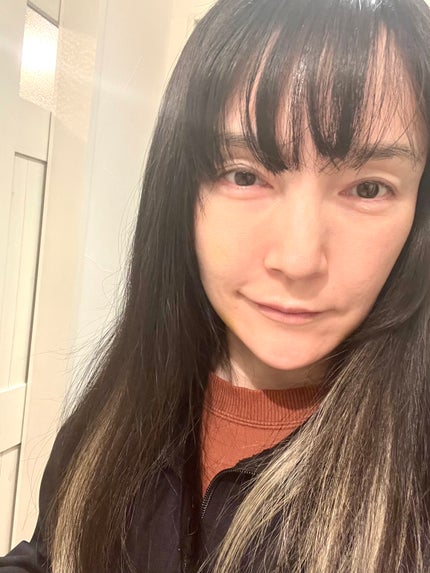 ダークスポットセラム/Anua/美容液を使ったクチコミ(3枚目)