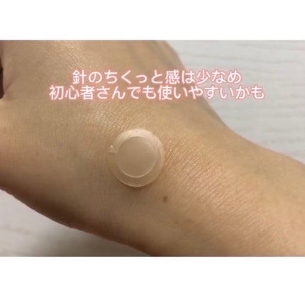 エーキュアショットスポットパッチ/obsero/にきびパッチを使ったクチコミ(5枚目)