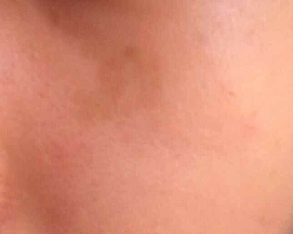 薬用ホワイトニングUVコンシーラー/トランシーノ/スティックコンシーラーを使ったクチコミ（2枚目）