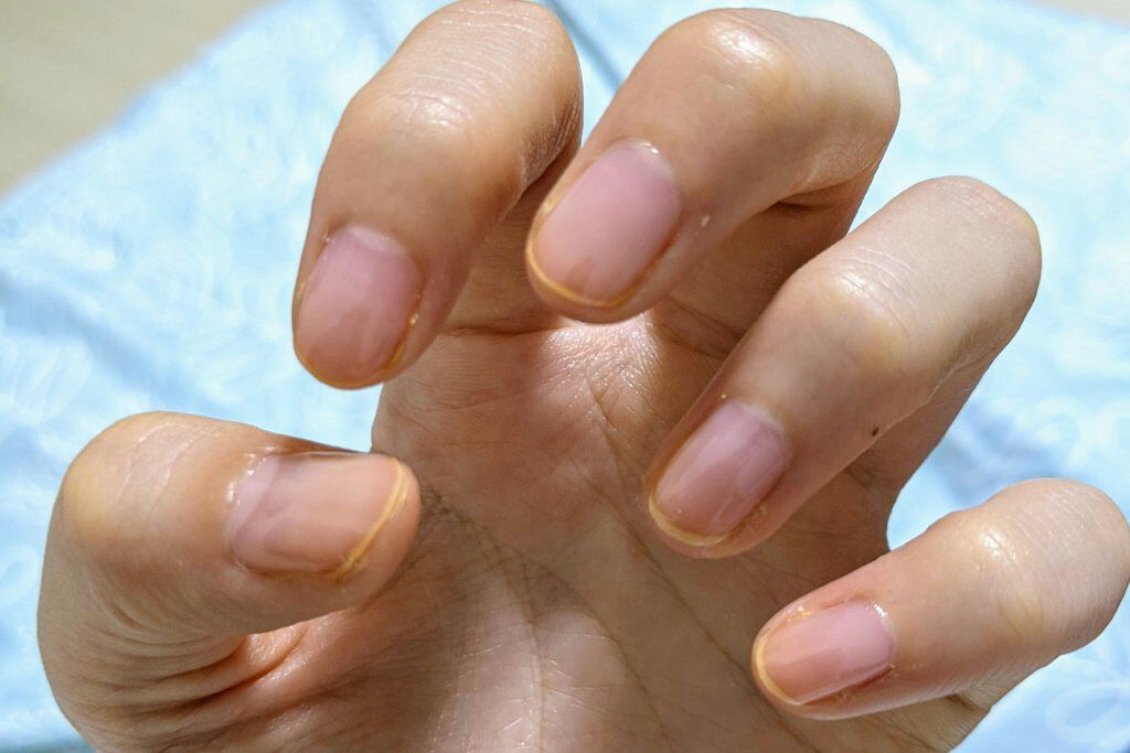 グロッシーコート/スキューズミー/オールインワンネイルを使ったクチコミ（1枚目）