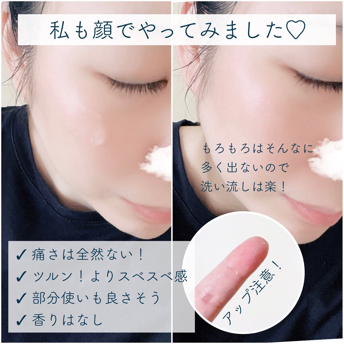 ピールショット/北の快適工房/ピーリングを使ったクチコミ(3枚目)