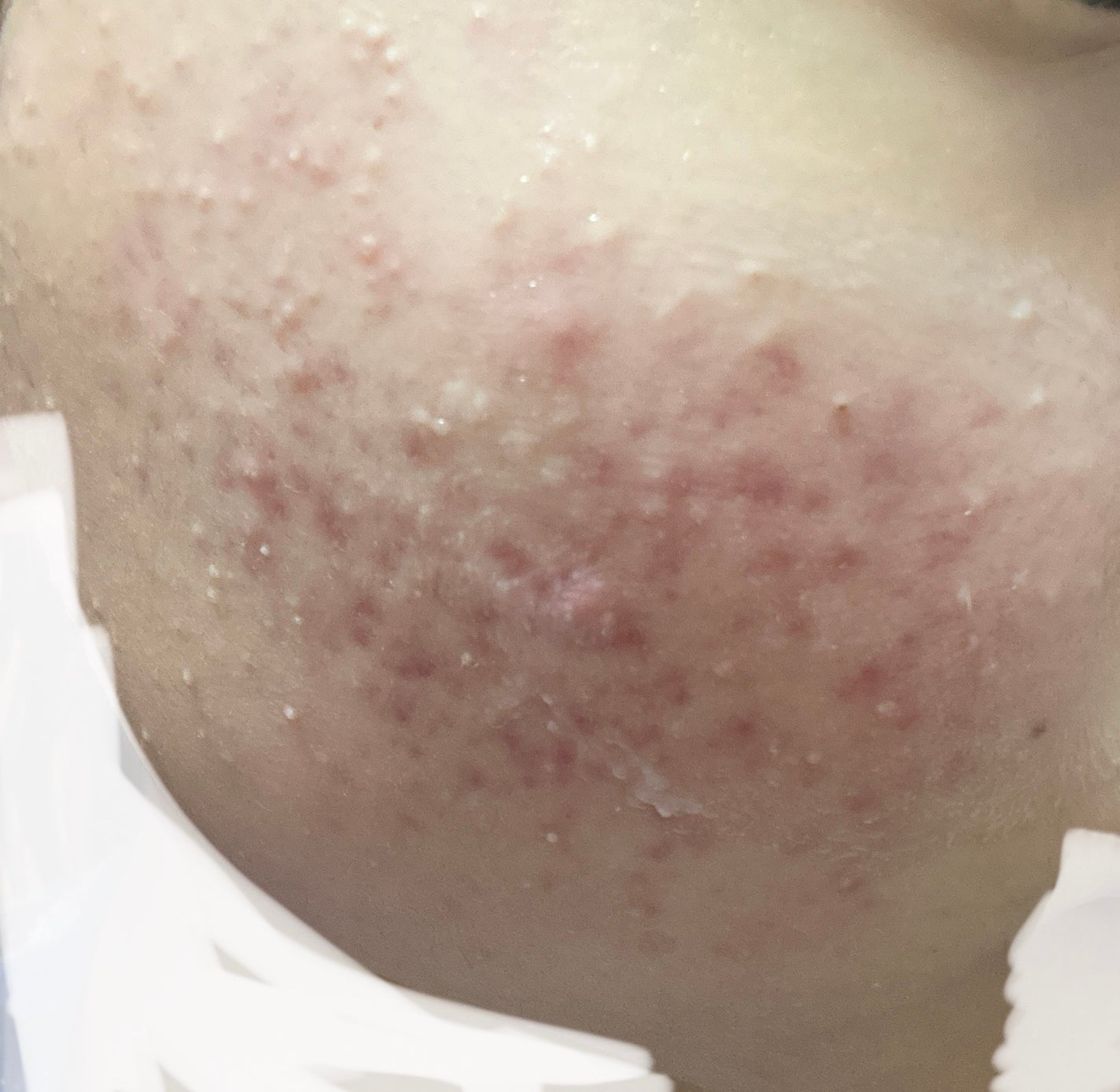 ð§ð»ãããïŒãããè·¡æ²æ»
âð»âª on LIPS ãèèãæ¥èšâ£ã ãã¶èµ€ã¿ãžã£ãŠããã§ãçœããããäžçããããð¡..ãïŒ1æç®ïŒ