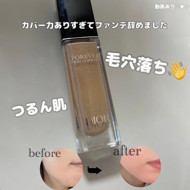 ディオールスキン フォーエヴァー スキン コレクト コンシーラー 1Nニュートラル/Dior/リキッドコンシーラーを使ったクチコミ（1枚目）