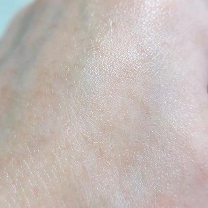 モイストゲルプラス/Re dermalab/オールインワン化粧品を使ったクチコミ(4枚目)