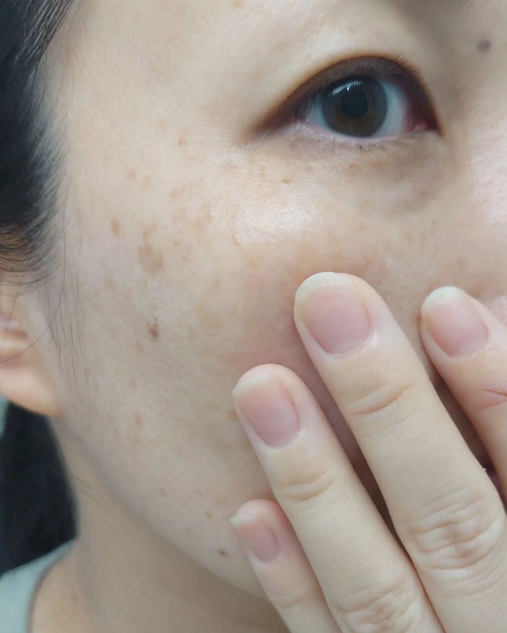 VC100エッセンスローション EX/ドクターシーラボⓇ/化粧水を使ったクチコミ(6枚目)