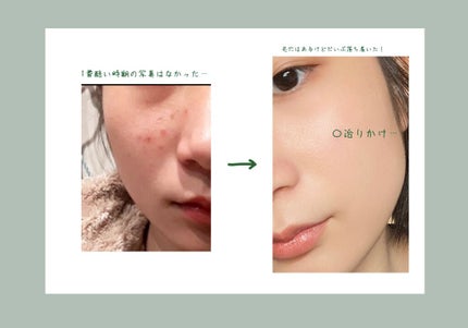 敏感肌用薬用美白美容液/無印良品/美容液を使ったクチコミ(2枚目)
