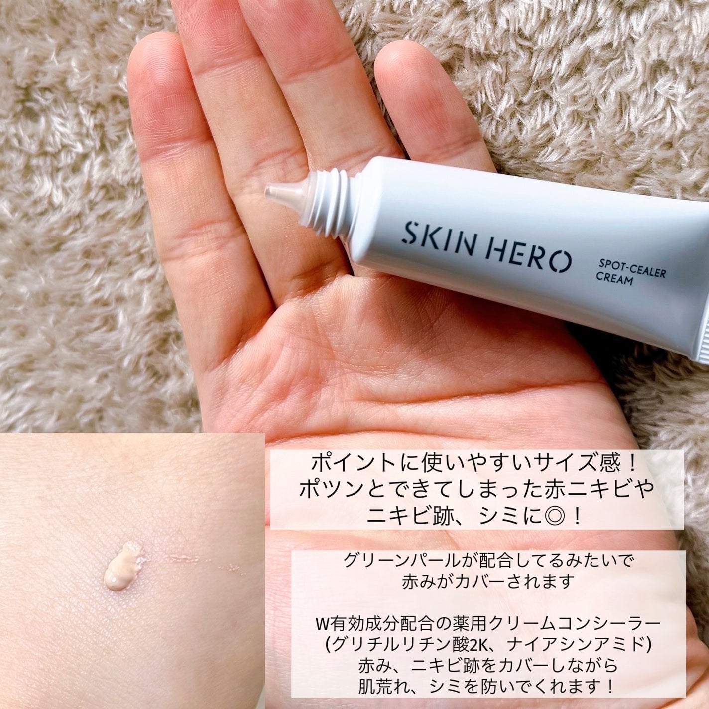 薬用スポットシーラークリーム/スキンヒーロー/クリームコンシーラーを使ったクチコミ(2枚目)