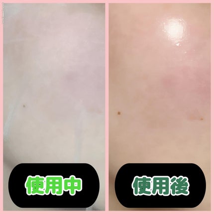 レッドブレミッシュクイックPHAシートマスク/Dr.G/シートマスク・パックを使ったクチコミ(5枚目)