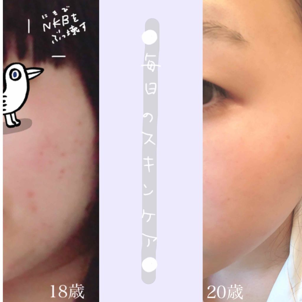 クリアモイスチャー L（さっぱりタイプ）/オルビス/乳液を使ったクチコミ（1枚目）