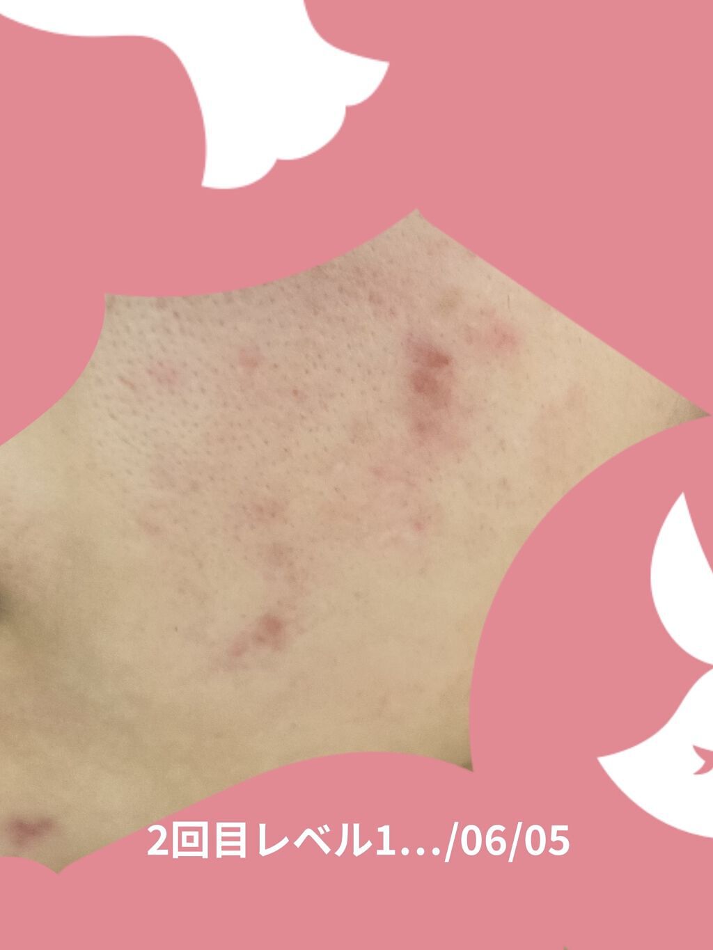 もち肌コラーゲンセラム3.0/MEDICUBE/美容液を使ったクチコミ（2枚目）