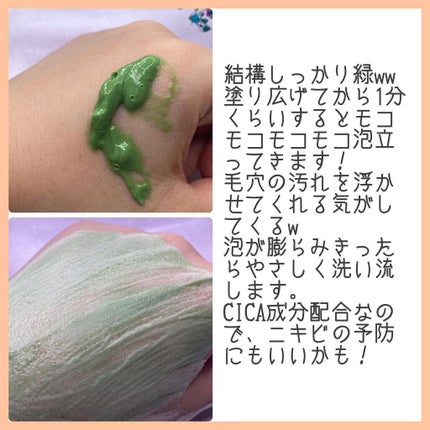 CICA マイルドトナーパッド/VT/トナーパッドを使ったクチコミ(4枚目)