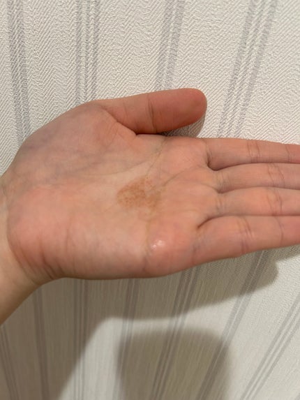 ベネフィーク セラム/BENEFIQUE/美容液を使ったクチコミ(2枚目)