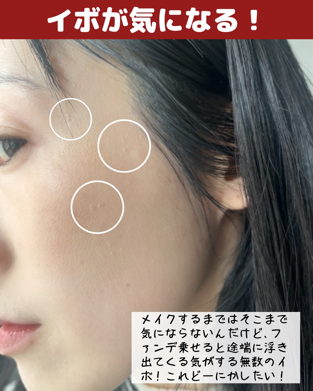 クラシエヨクイニンタブレット（医薬品）/クラシエ薬品/その他を使ったクチコミ（2枚目）