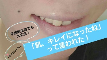 ビタペアC集中美容液スペシャルセット/ネイチャーリパブリック/美容液を使ったクチコミ（1枚目）