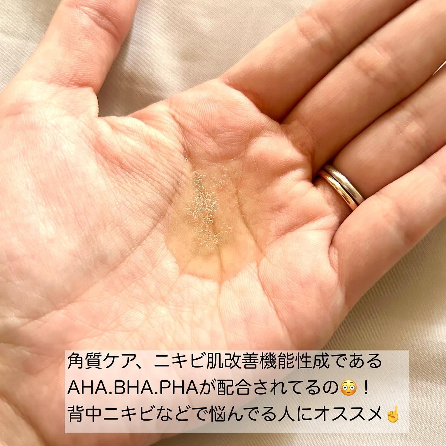 AHA·BHA·PHA 30デイズミラクルアクネボディクレンザー/SOME BY MI/ボディソープを使ったクチコミ（3枚目）