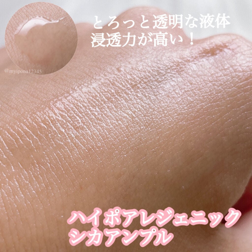 ハイポアレジェニック シカ ジェルクリーム/Dermatory/フェイスクリームを使ったクチコミ(2枚目)