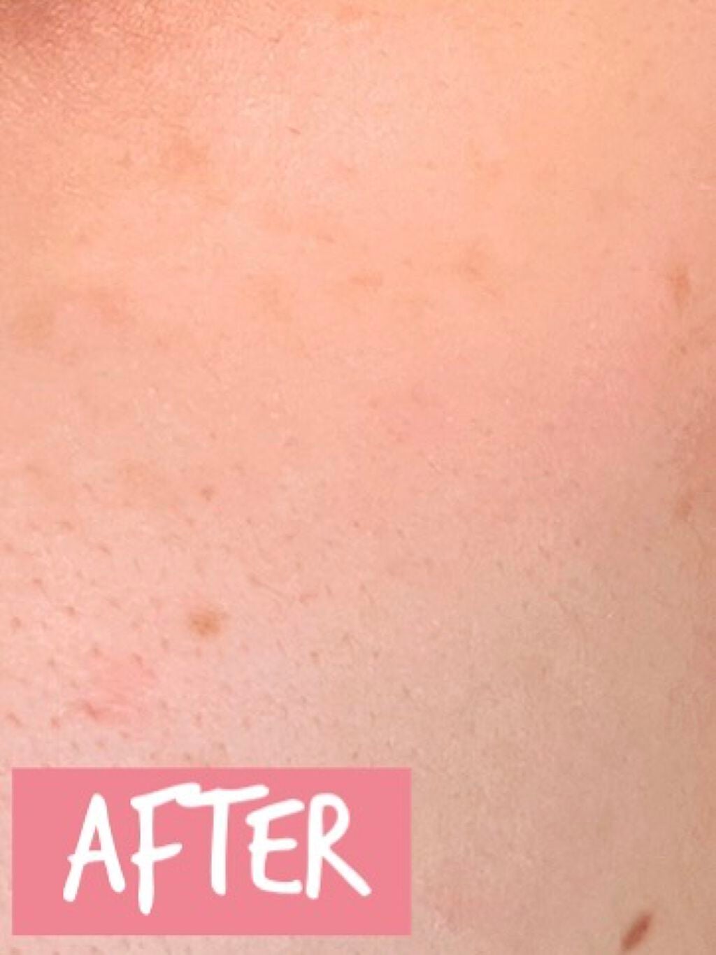 ビタミントーニングシミセラム/BIOHEAL BOH/美容液を使ったクチコミ(3枚目)