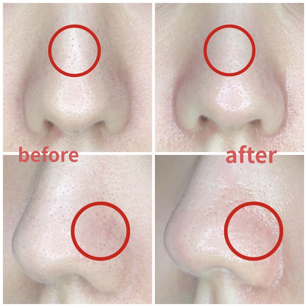 スチーマーナノケア EH-SA9A/Panasonic/美顔器・マッサージを使ったクチコミ（3枚目）