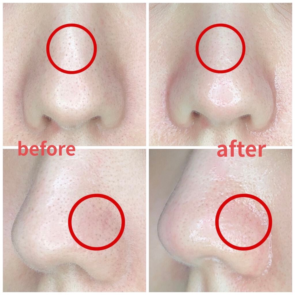 ポアヌーク ザ・ポアクリアスティック/STYLE+NOBLE/その他スキンケアグッズを使ったクチコミ(3枚目)