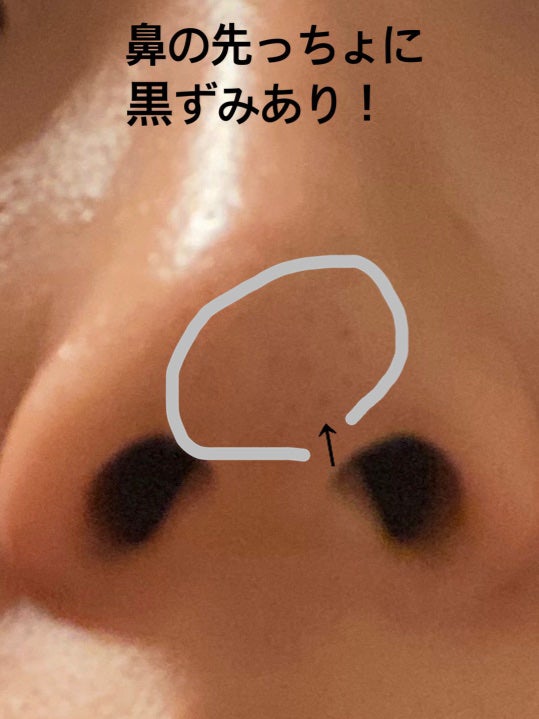 アリウルアップルサイダーディープクレンジングオイル/Ariul/オイルクレンジングを使ったクチコミ(3枚目)