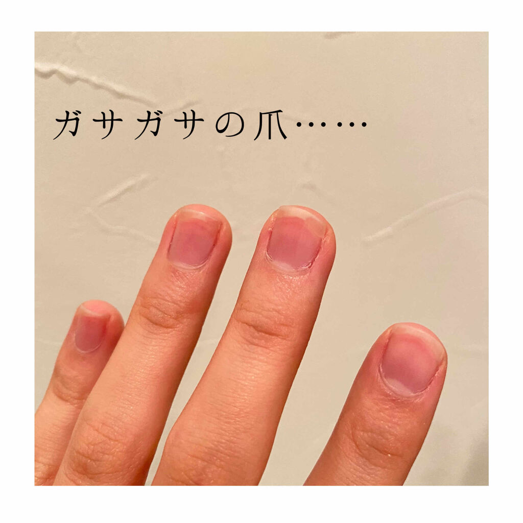 ウィンマックス キューティクルオイル/DAISO/ネイルオイル・トリートメントを使ったクチコミ（2枚目）