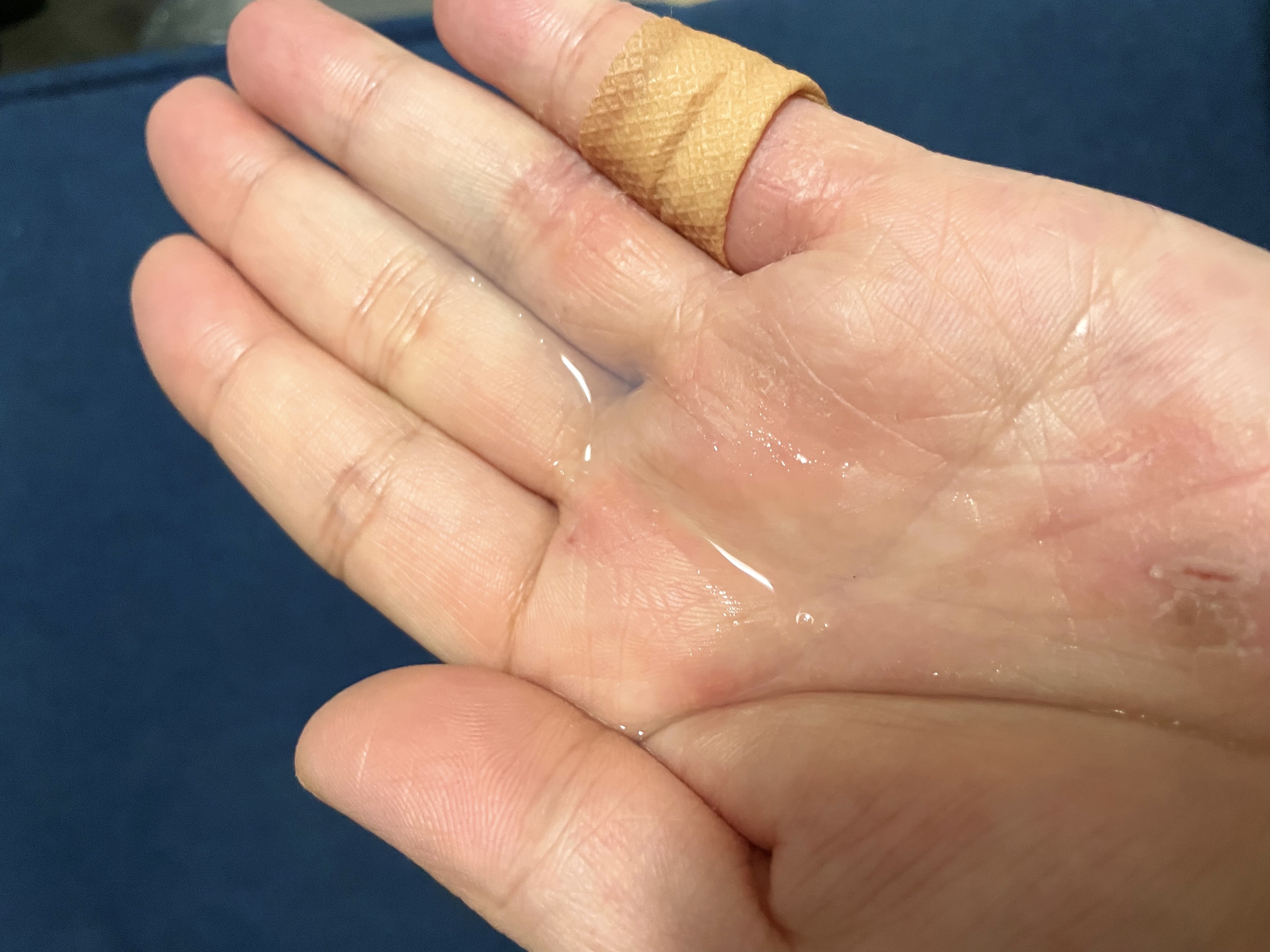 白潤薬用美白ジェル/肌ラボ/フェイスクリームを使ったクチコミ（3枚目）