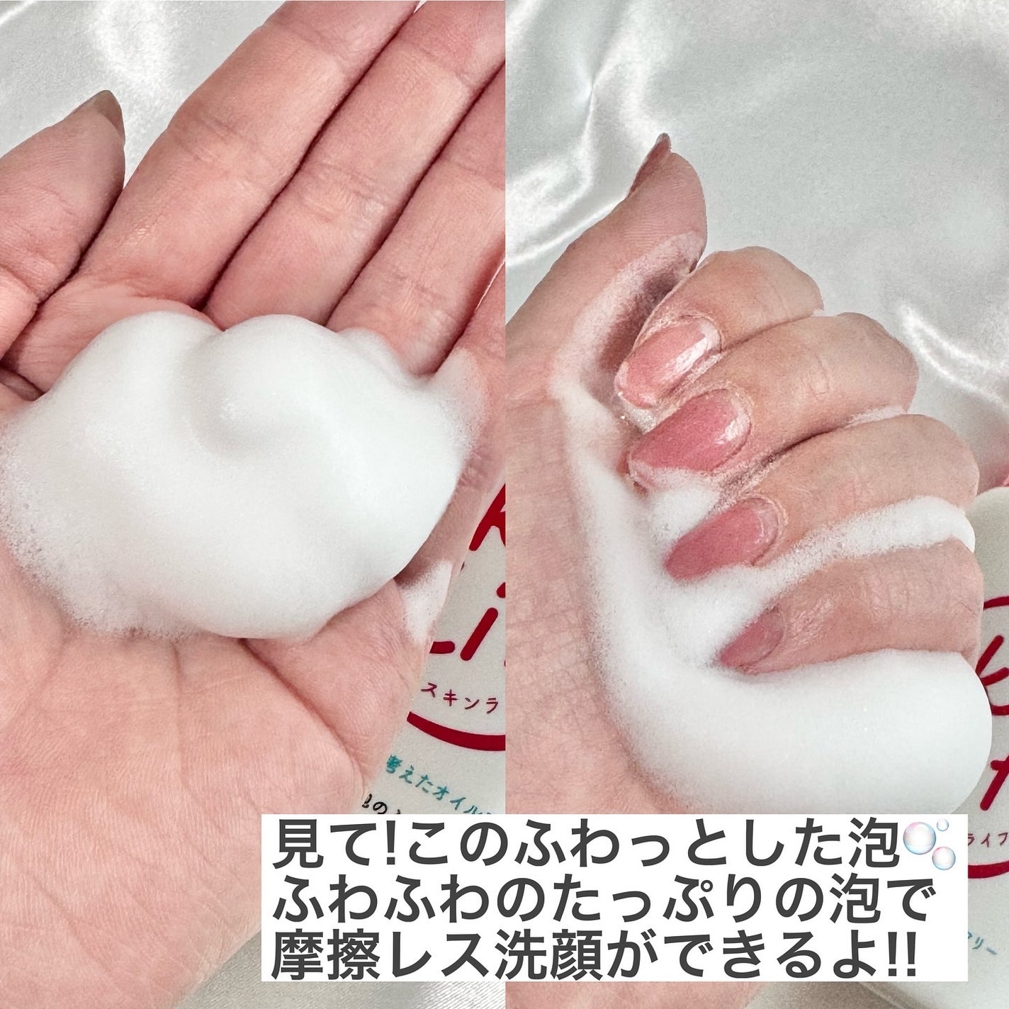 薬用化粧水/スキンライフ/化粧水を使ったクチコミ(6枚目)