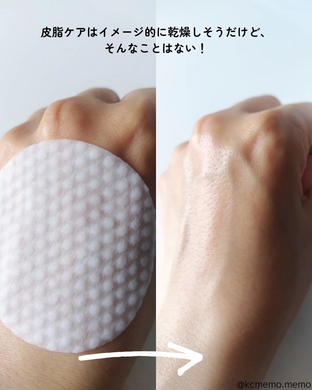 ゼロ毛穴パッド 2.0/MEDICUBE/トナーパッドを使ったクチコミ(7枚目)