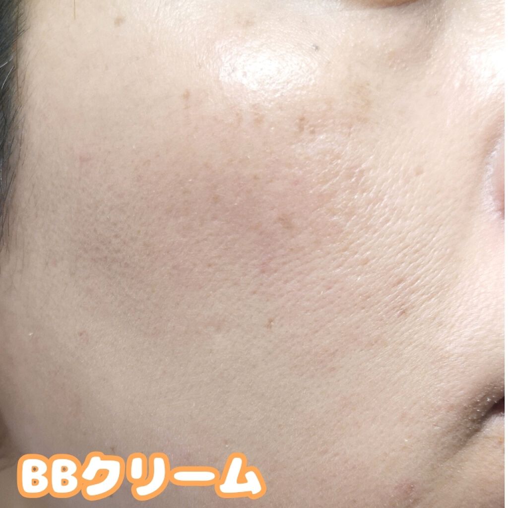 ホワイトニングクリアエマルジョン/d プログラム/乳液を使ったクチコミ（3枚目）