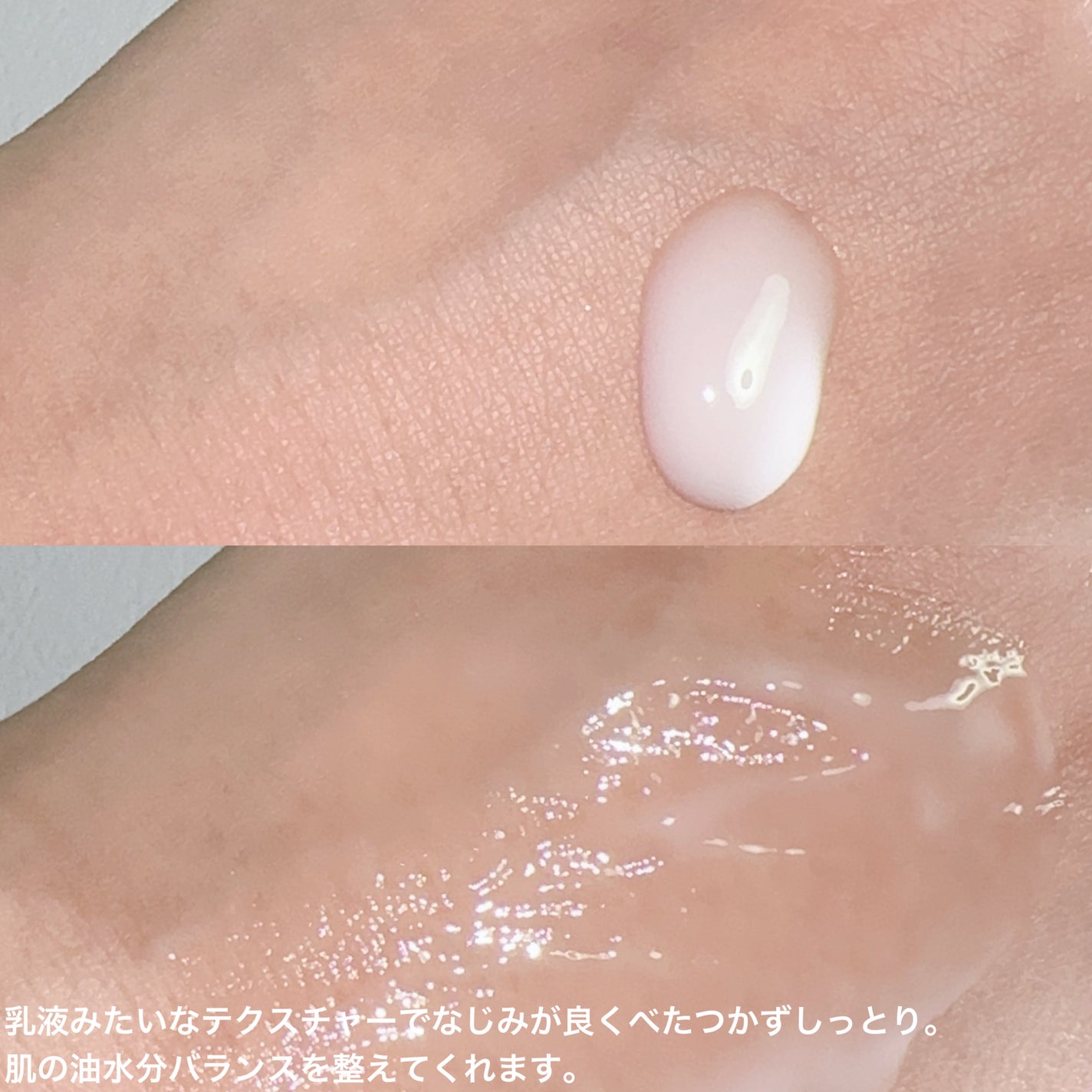 アゼペア 美容液/ネイチャーリパブリック/美容液を使ったクチコミ(3枚目)