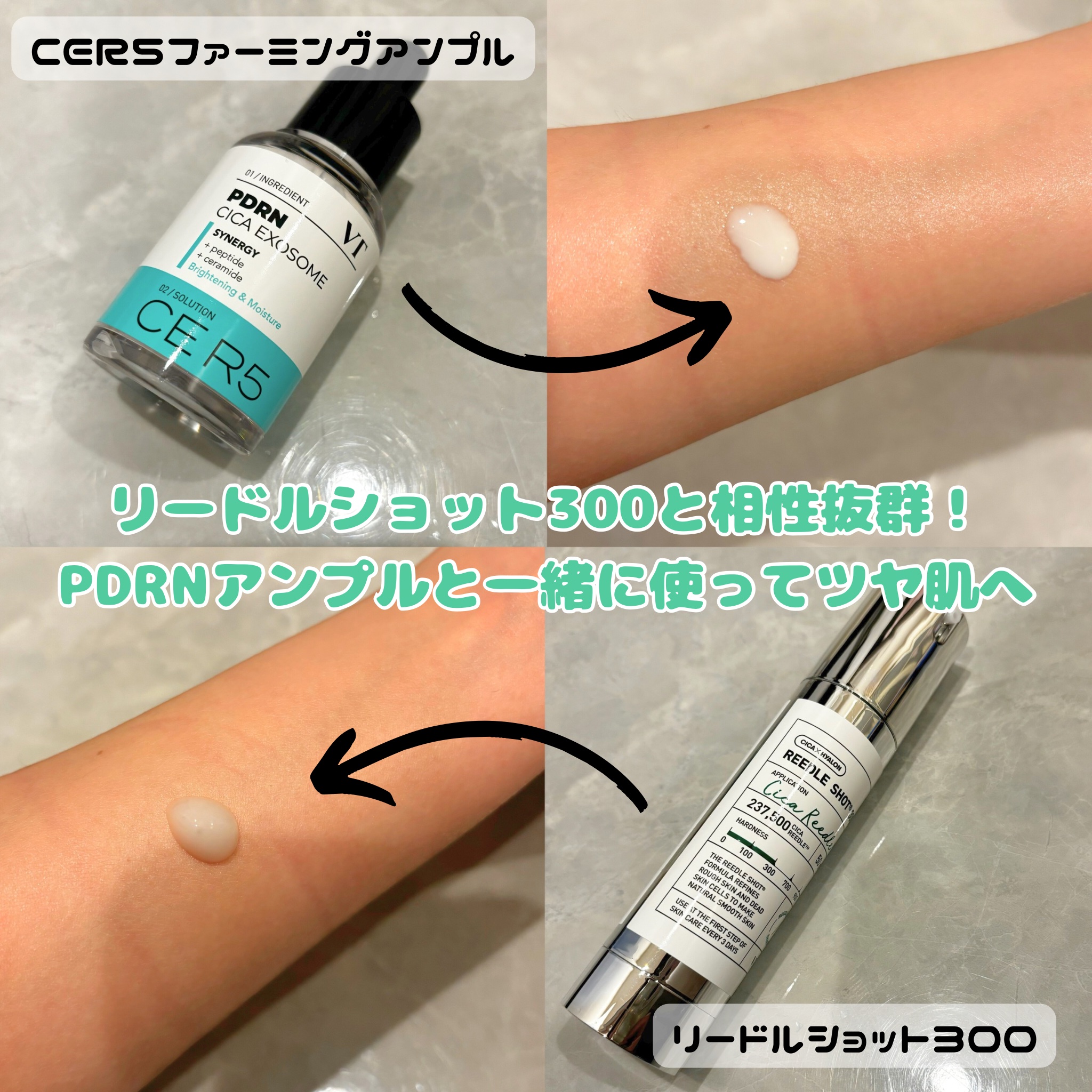 リードルショット300/VT/美容液を使ったクチコミ（3枚目）