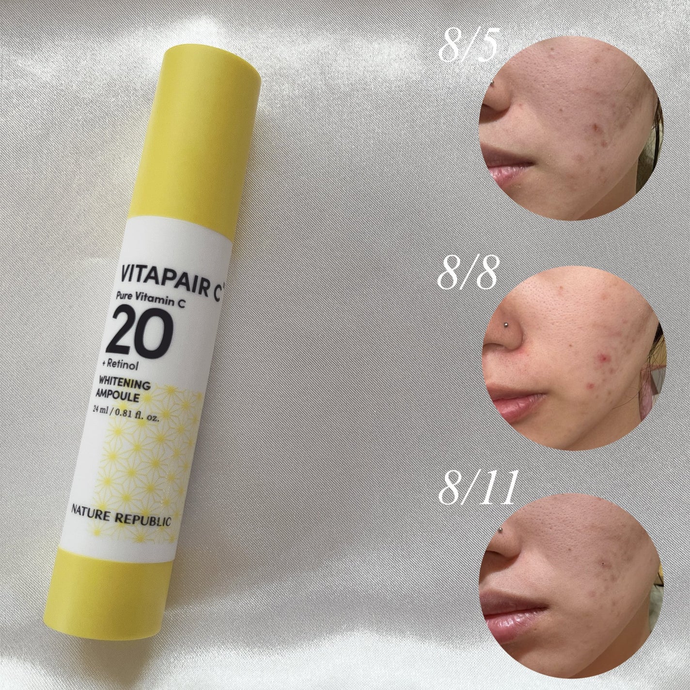 ビタペアC ビタレチ美容液/ネイチャーリパブリック/美容液を使ったクチコミ(3枚目)