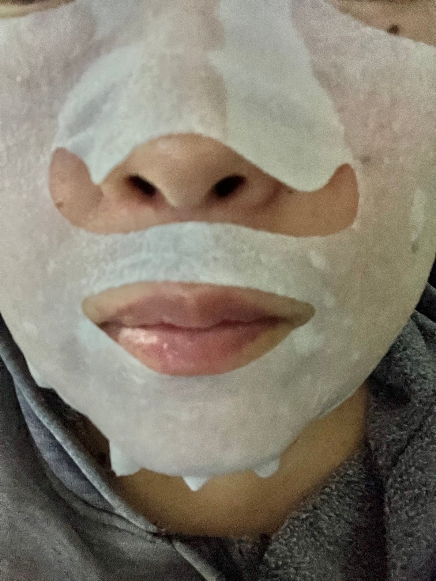 ルルルン ハイドラ V マスク/ルルルン/シートマスク・パックを使ったクチコミ(5枚目)